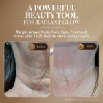 Rechargeable Led Face - Hình 6