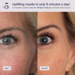 White Contouring Device - Hình 3