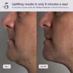 White Contouring Device - Hình 4